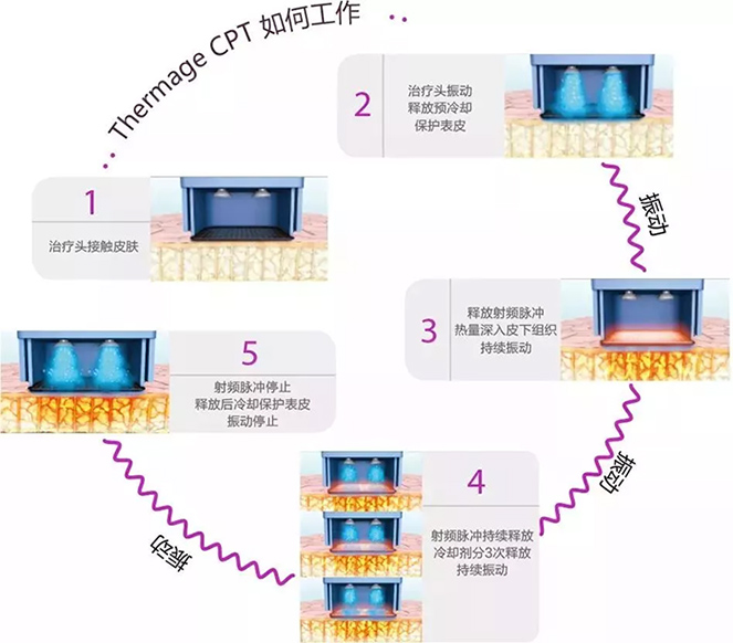 热玛吉设备价格